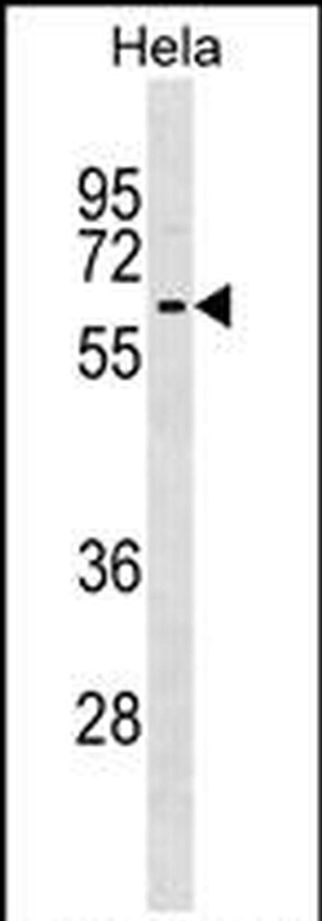 KLHL12 Antibody in Western Blot (WB)