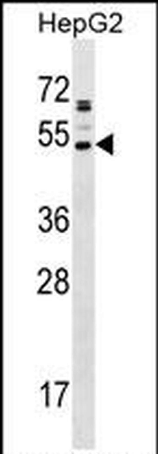 AADACL2 Antibody in Western Blot (WB)