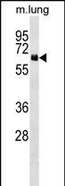 NET1 Antibody in Western Blot (WB)