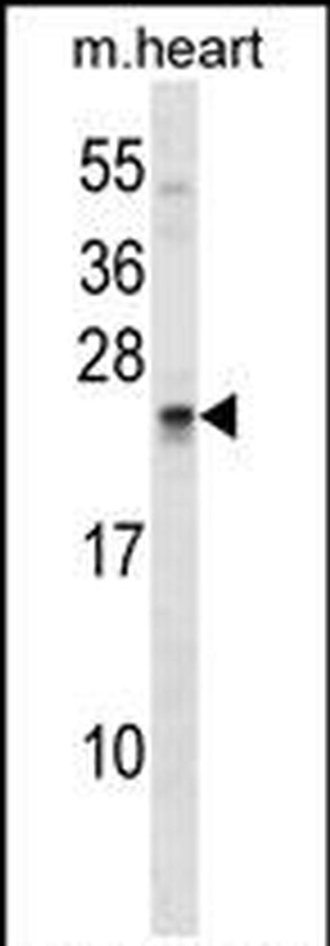 Sostdc1 Antibody in Western Blot (WB)