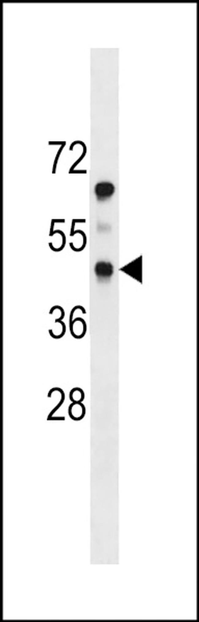 PDGFRL Antibody in Western Blot (WB)