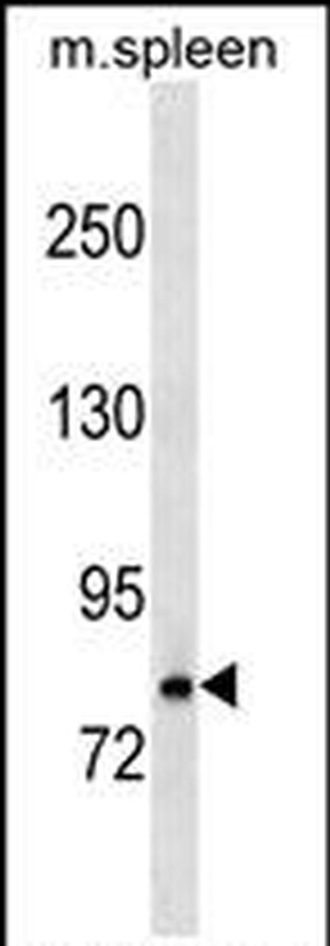 RNaseL Antibody in Western Blot (WB)