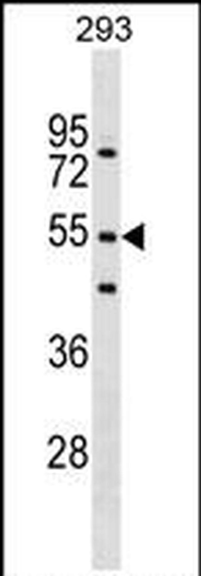 FBXW9 Antibody in Western Blot (WB)