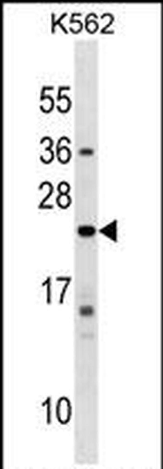 Interferon alpha-10 Antibody in Western Blot (WB)