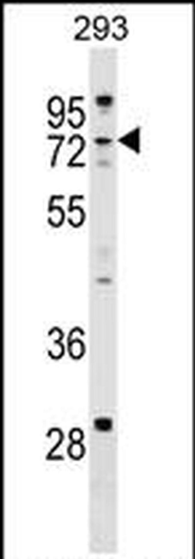 ZCCHC8 Antibody in Western Blot (WB)