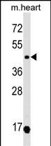 Oxytocin Receptor Antibody in Western Blot (WB)