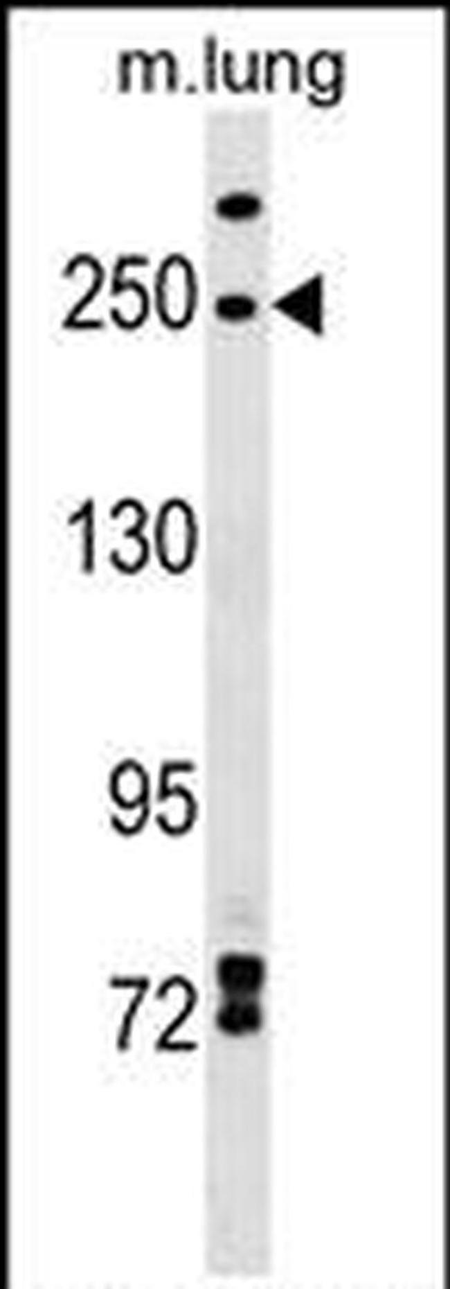 INF2 Antibody in Western Blot (WB)