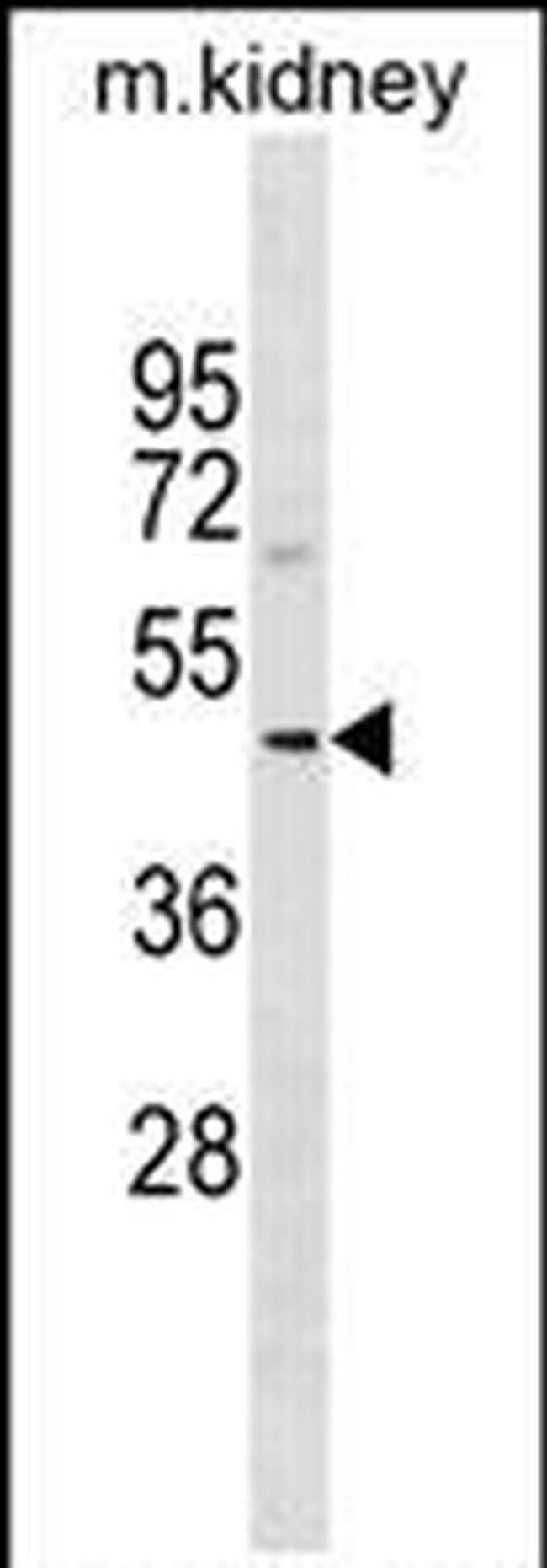 SDS3 Antibody in Western Blot (WB)