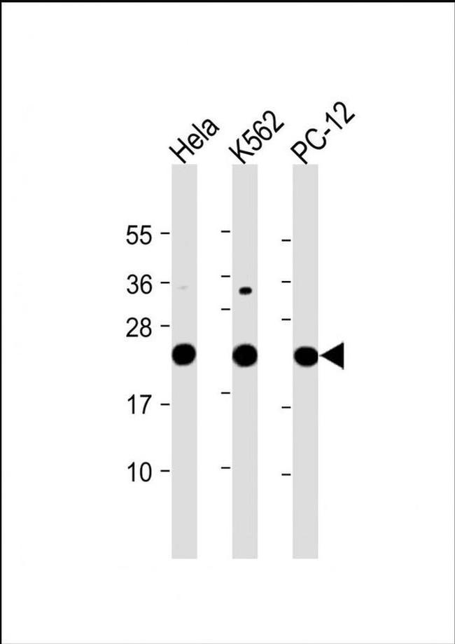 LZIC Antibody in Western Blot (WB)