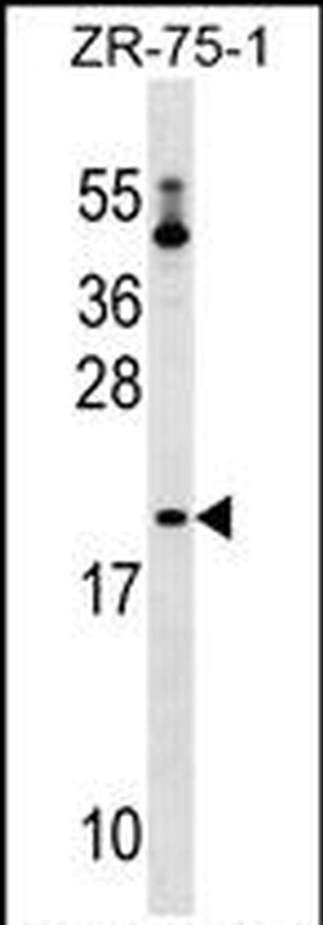 Bit1 Antibody in Western Blot (WB)