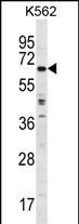 TRIM75P Antibody in Western Blot (WB)