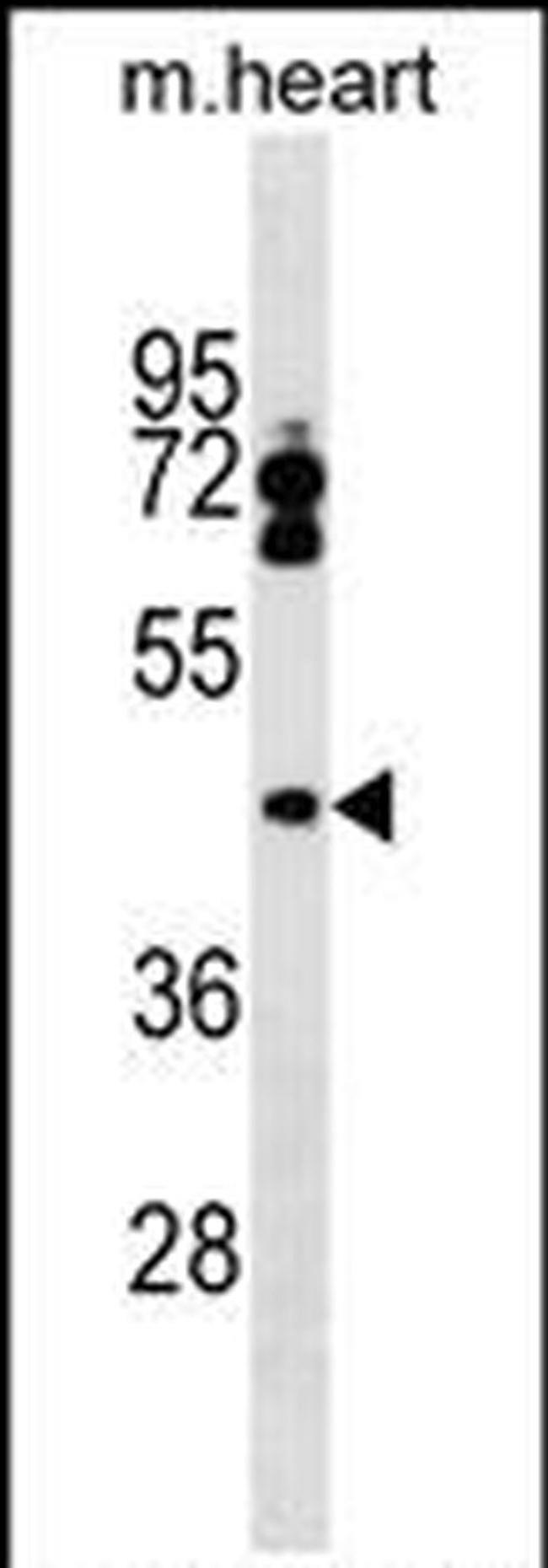 LPXN Antibody in Western Blot (WB)