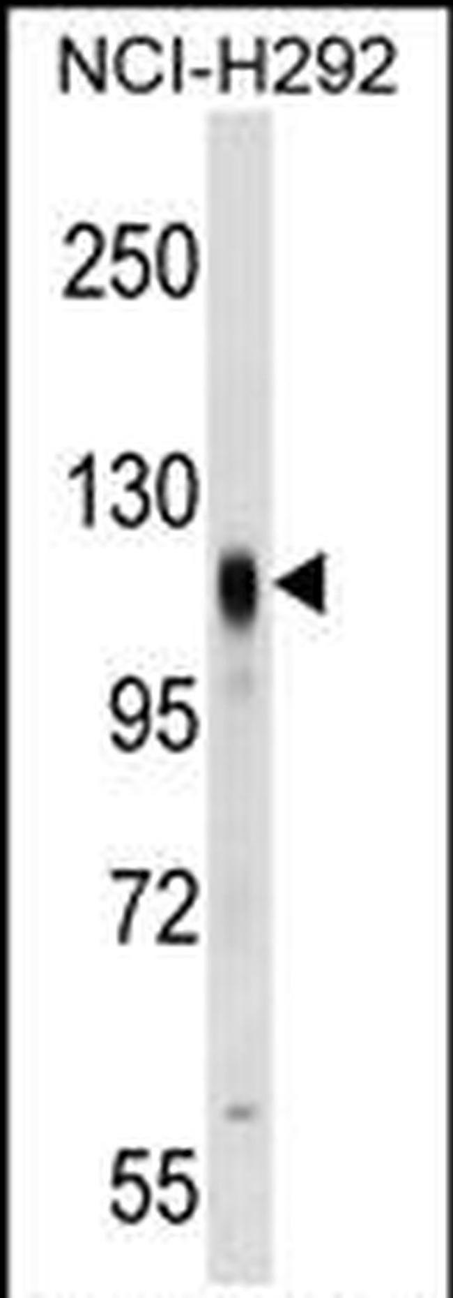 Prominin 2 Antibody in Western Blot (WB)