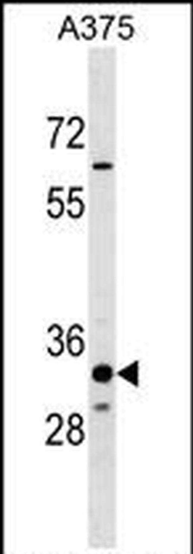 THEM5 Antibody in Western Blot (WB)