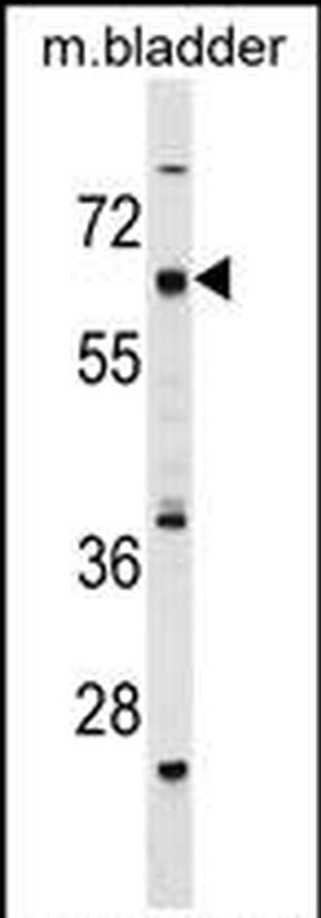 CECR6 Antibody in Western Blot (WB)