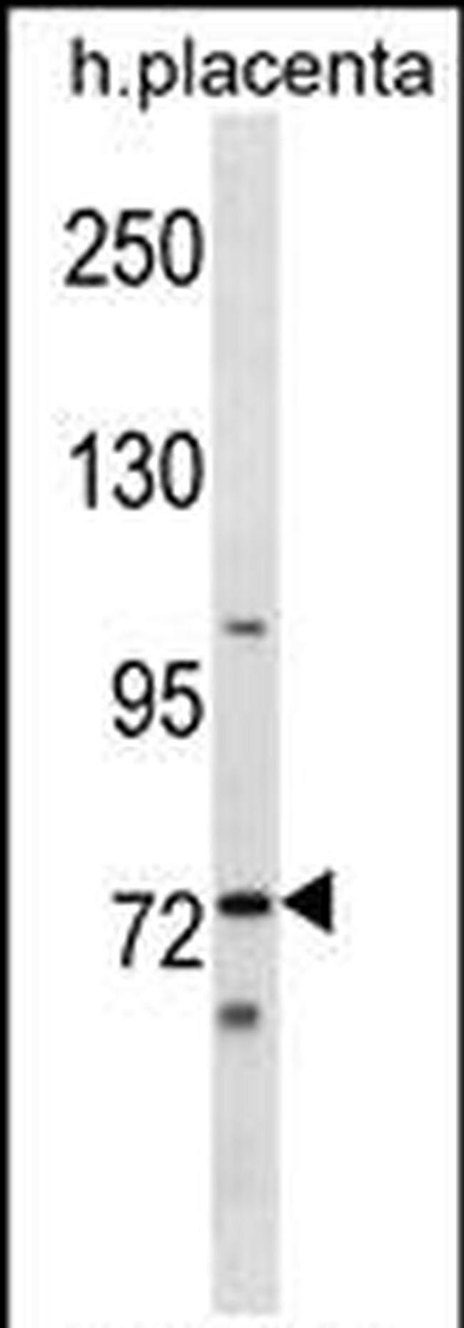 STKLD1 Antibody in Western Blot (WB)