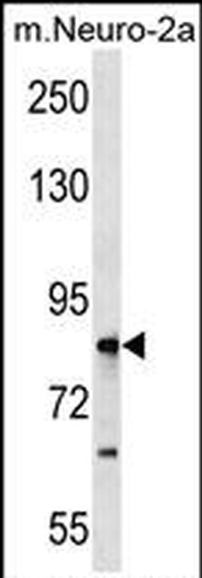 RNF207 Antibody in Western Blot (WB)