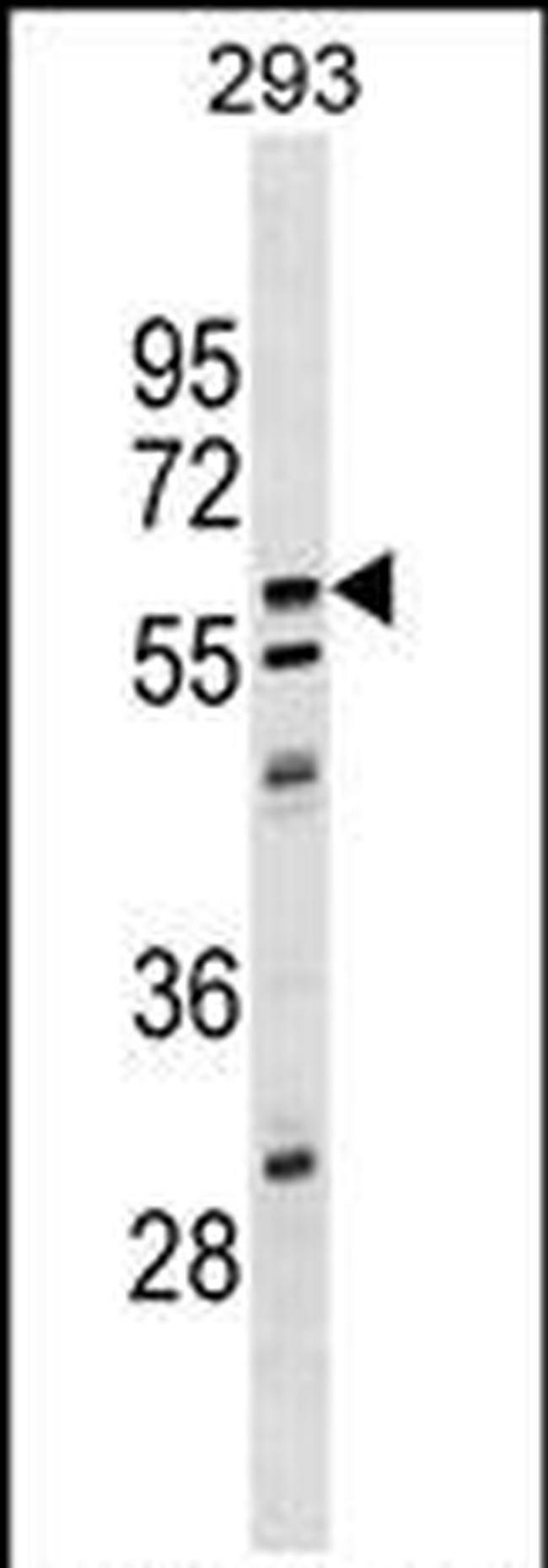 CPNE5 Antibody in Western Blot (WB)