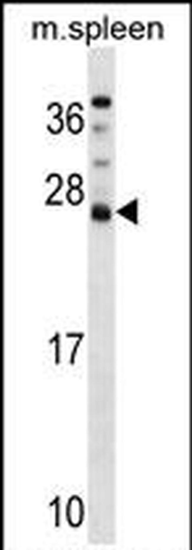 DNAJC5B Antibody in Western Blot (WB)