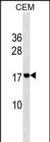 ADM2 Antibody in Western Blot (WB)