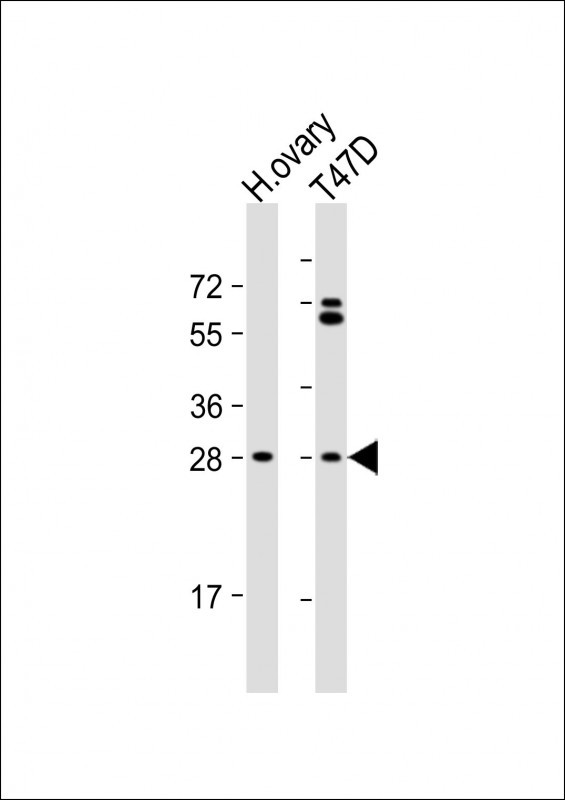 FIGLA Antibody in Western Blot (WB)