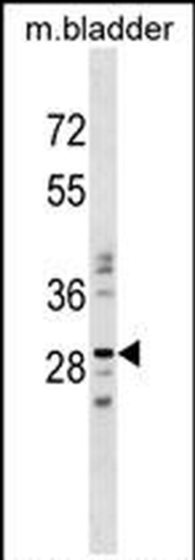 NUBPL Antibody in Western Blot (WB)