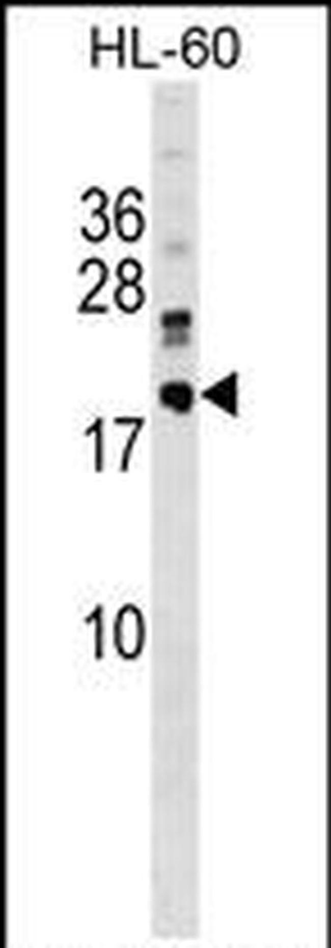 DNAJC30 Antibody in Western Blot (WB)