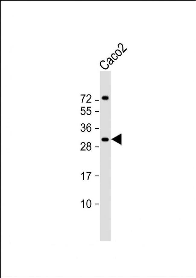 RASL12 Antibody in Western Blot (WB)