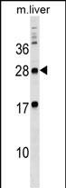 MPZL3 Antibody in Western Blot (WB)