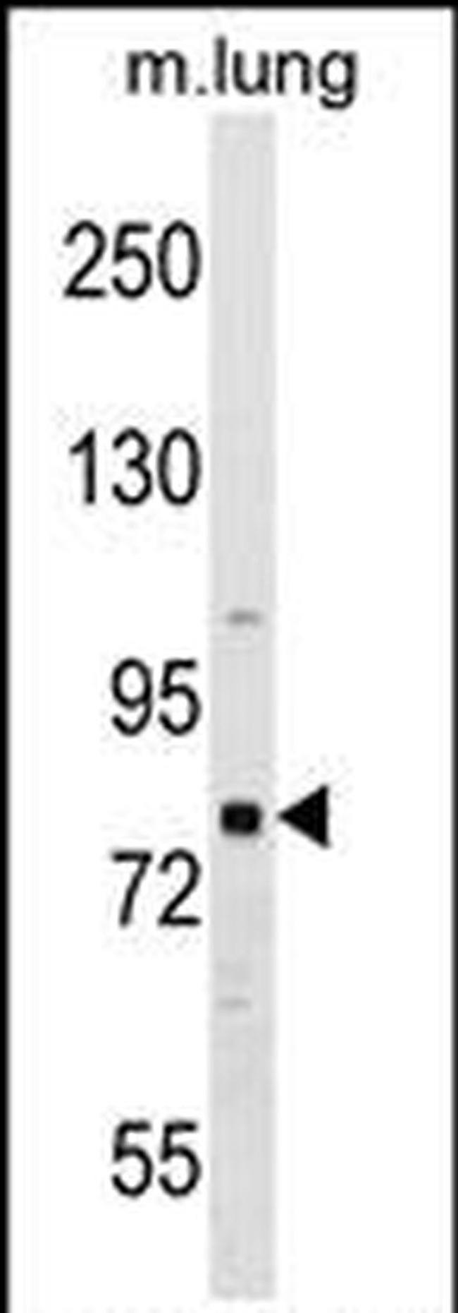 RHPN1 Antibody in Western Blot (WB)