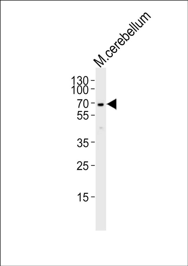 MTF2 Antibody in Western Blot (WB)