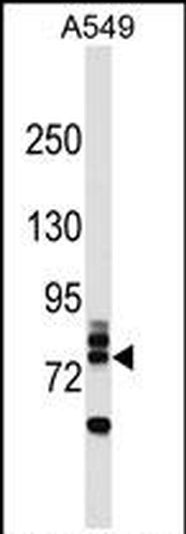 RNF157 Antibody in Western Blot (WB)