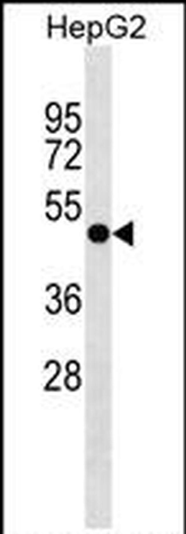 FAPP2 Antibody in Western Blot (WB)