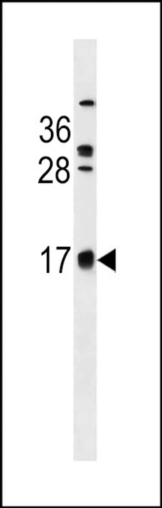 C2orf83 Antibody in Western Blot (WB)