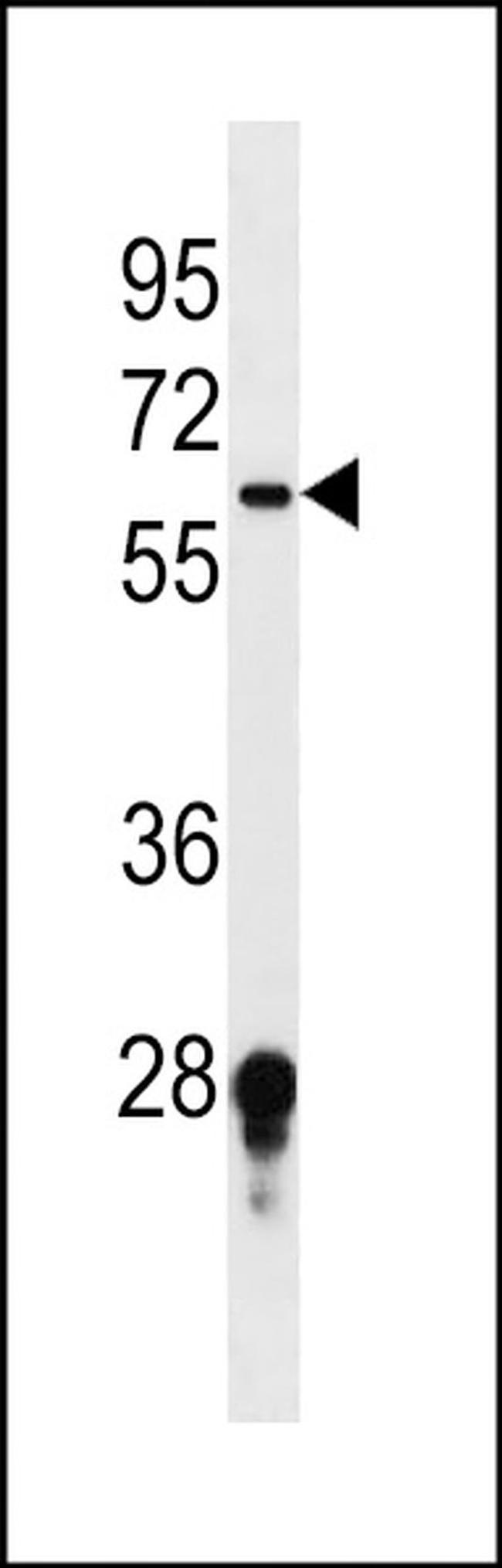 FUT11 Antibody in Western Blot (WB)