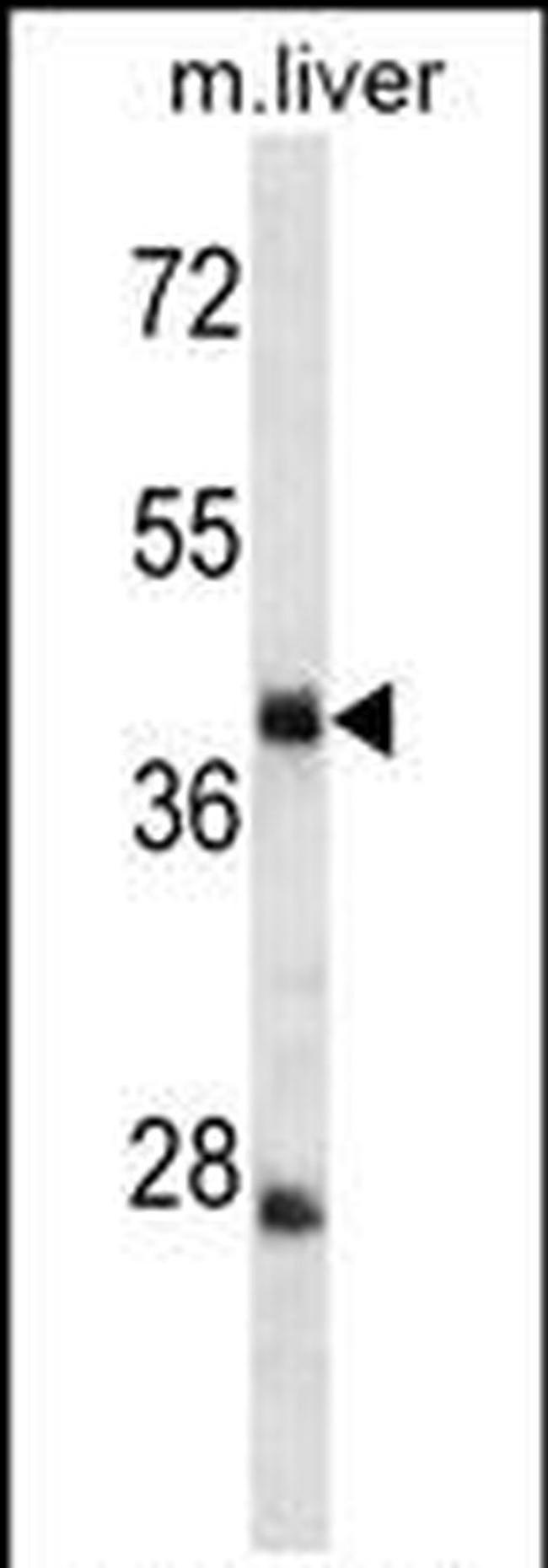TRIM44 Antibody in Western Blot (WB)