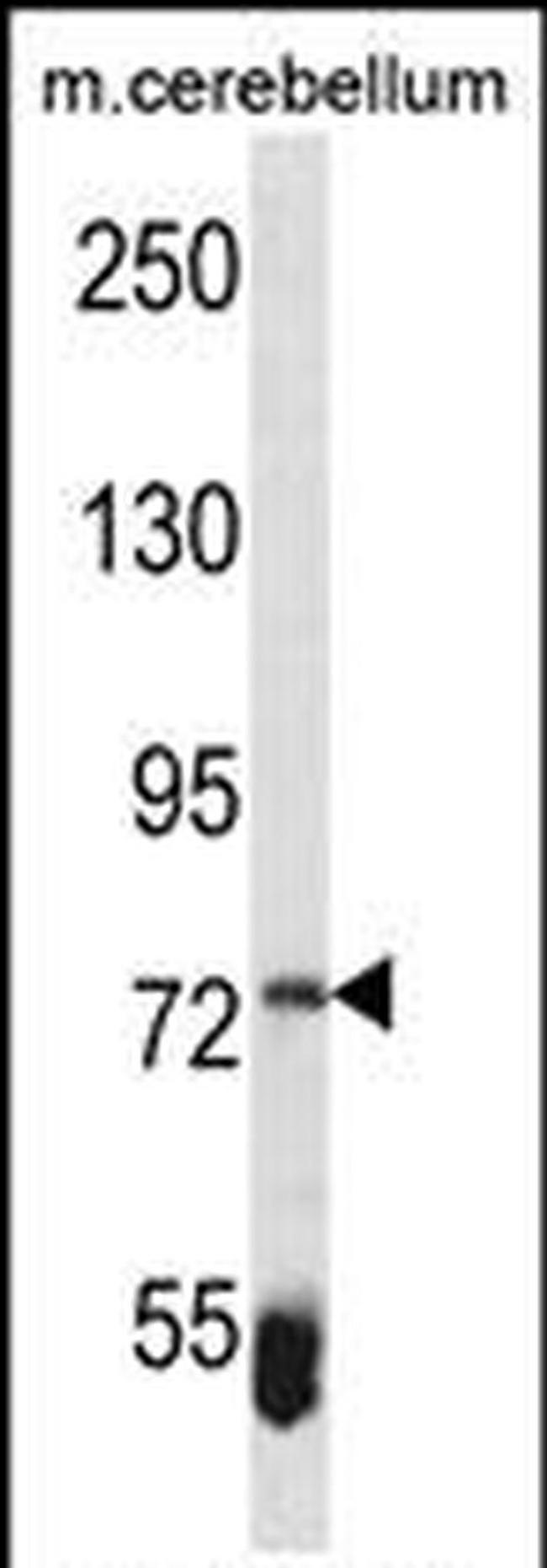 ZBTB39 Antibody in Western Blot (WB)