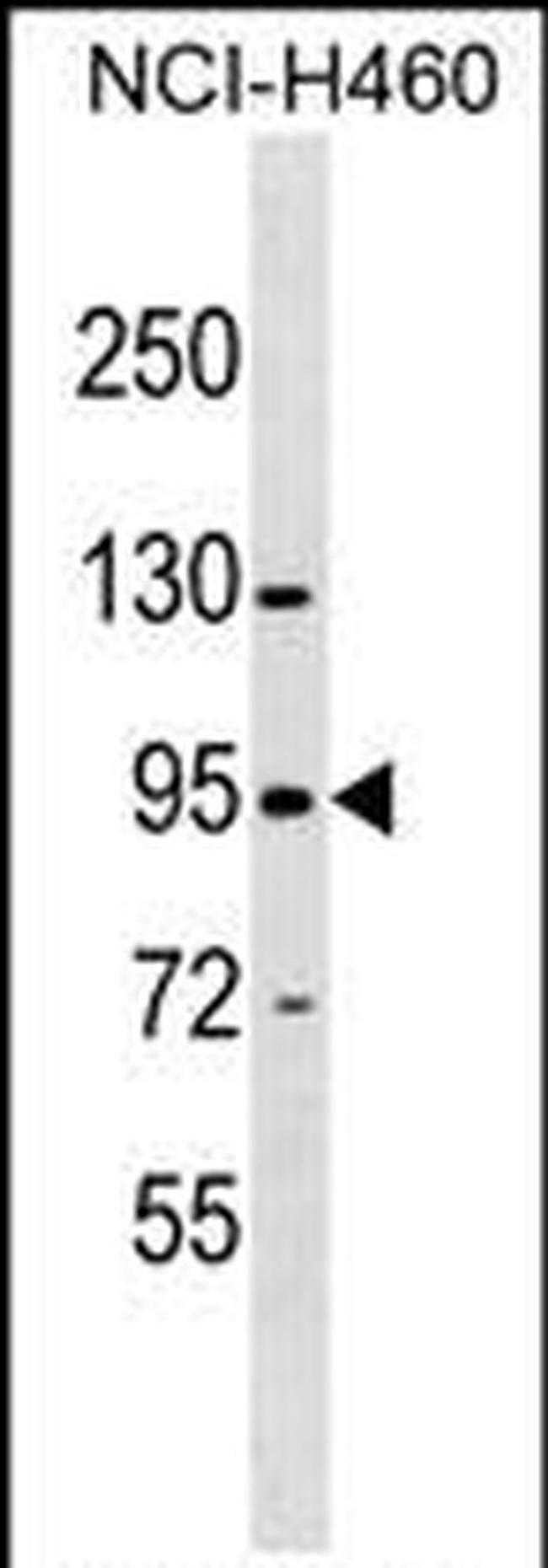 ZNF484 Antibody in Western Blot (WB)