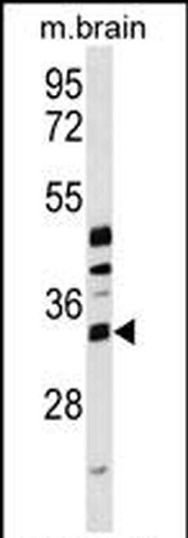 METTL6 Antibody in Western Blot (WB)