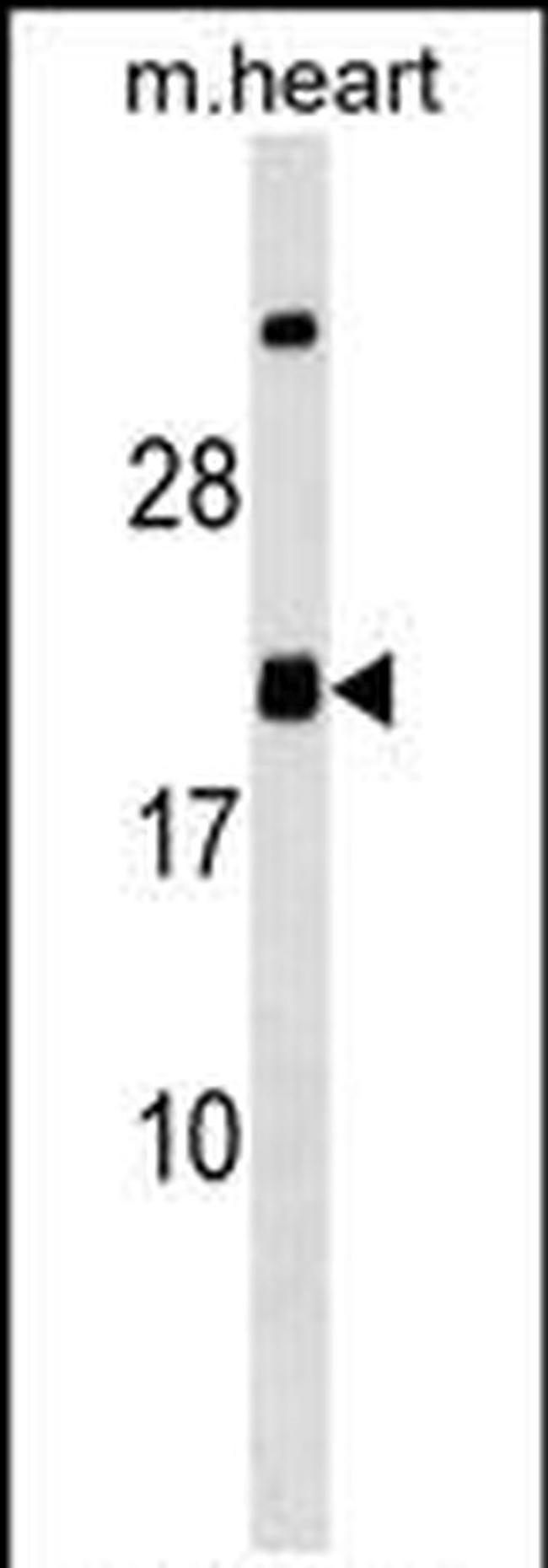MED9 Antibody in Western Blot (WB)
