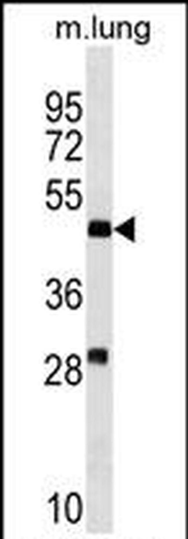 RNF150 Antibody in Western Blot (WB)