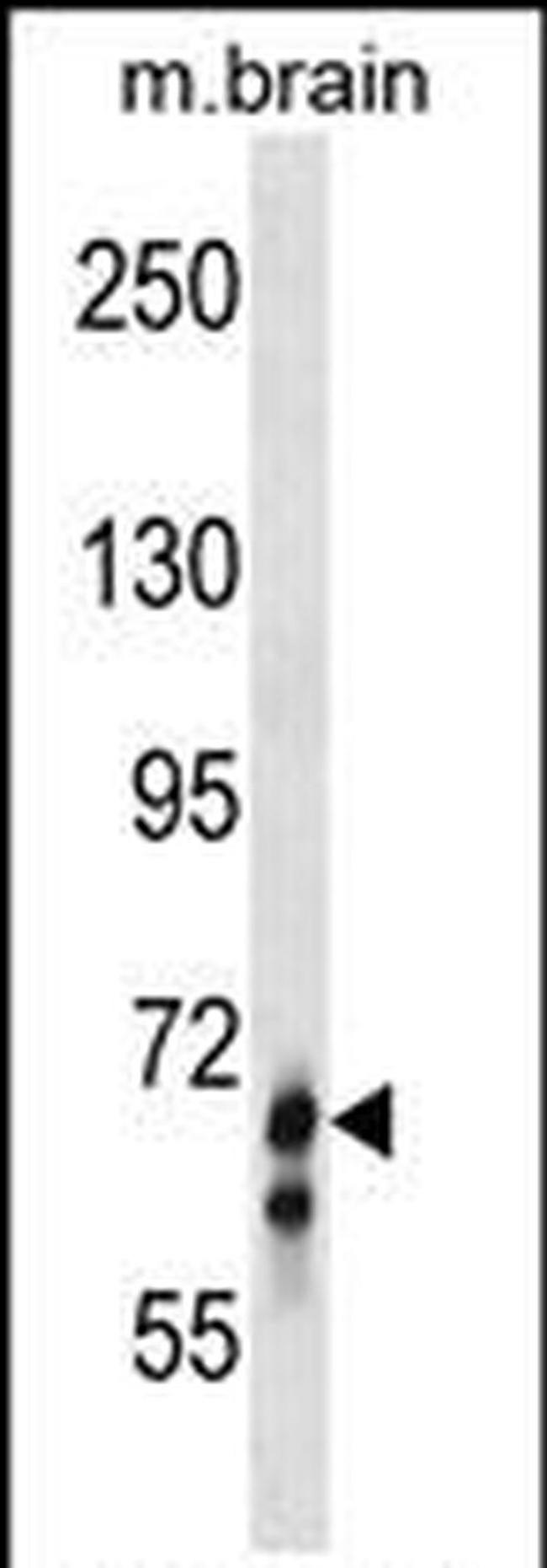 GLB1L Antibody in Western Blot (WB)