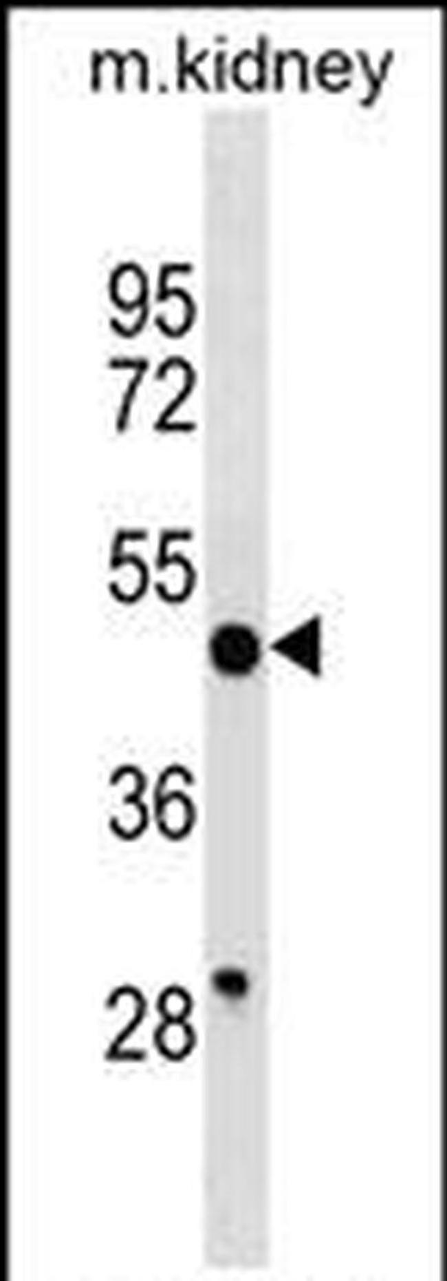 HGH1 Antibody in Western Blot (WB)