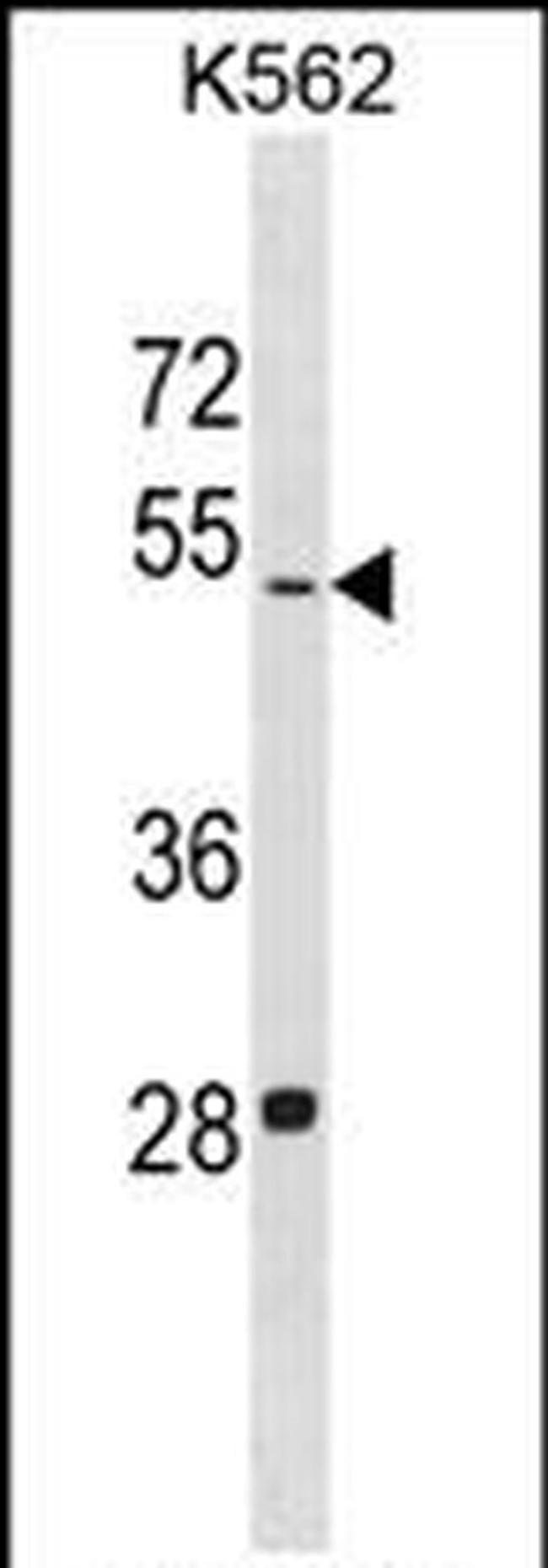 LDHAL6B Antibody in Western Blot (WB)