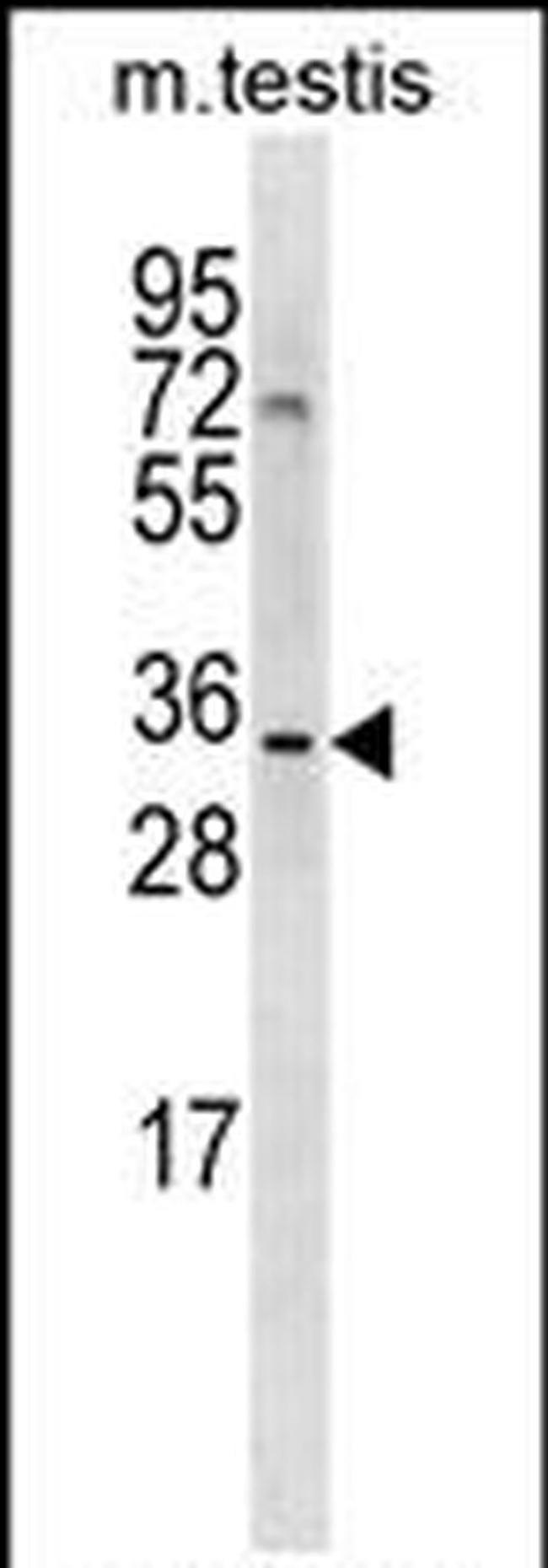 SHARPIN Antibody in Western Blot (WB)