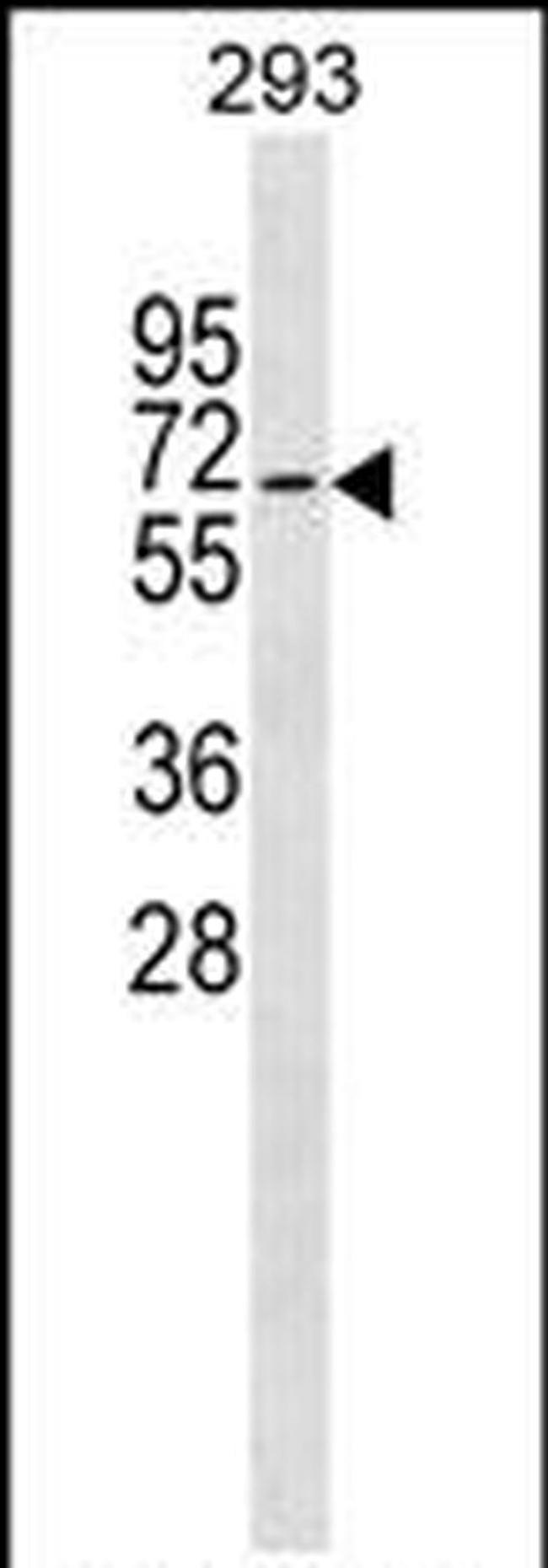 ZWILCH Antibody in Western Blot (WB)