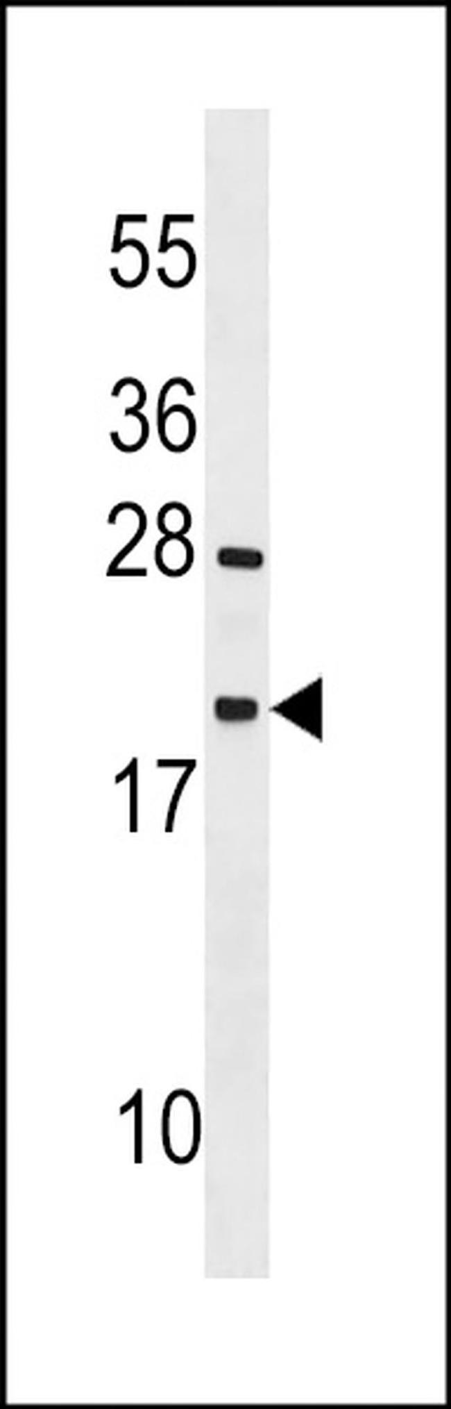TEX12 Antibody in Western Blot (WB)