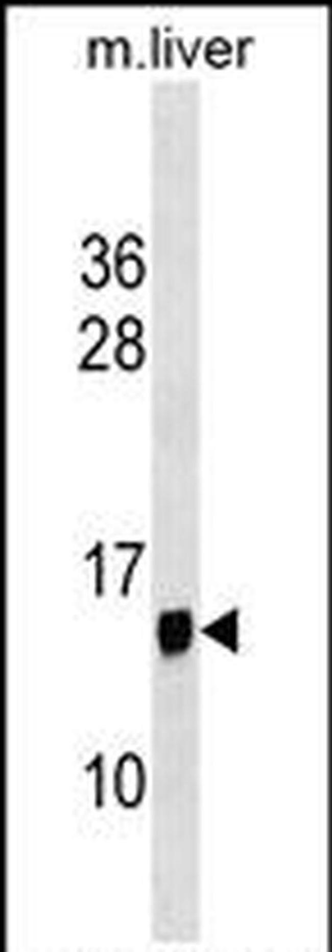PPP1R1C Antibody in Western Blot (WB)