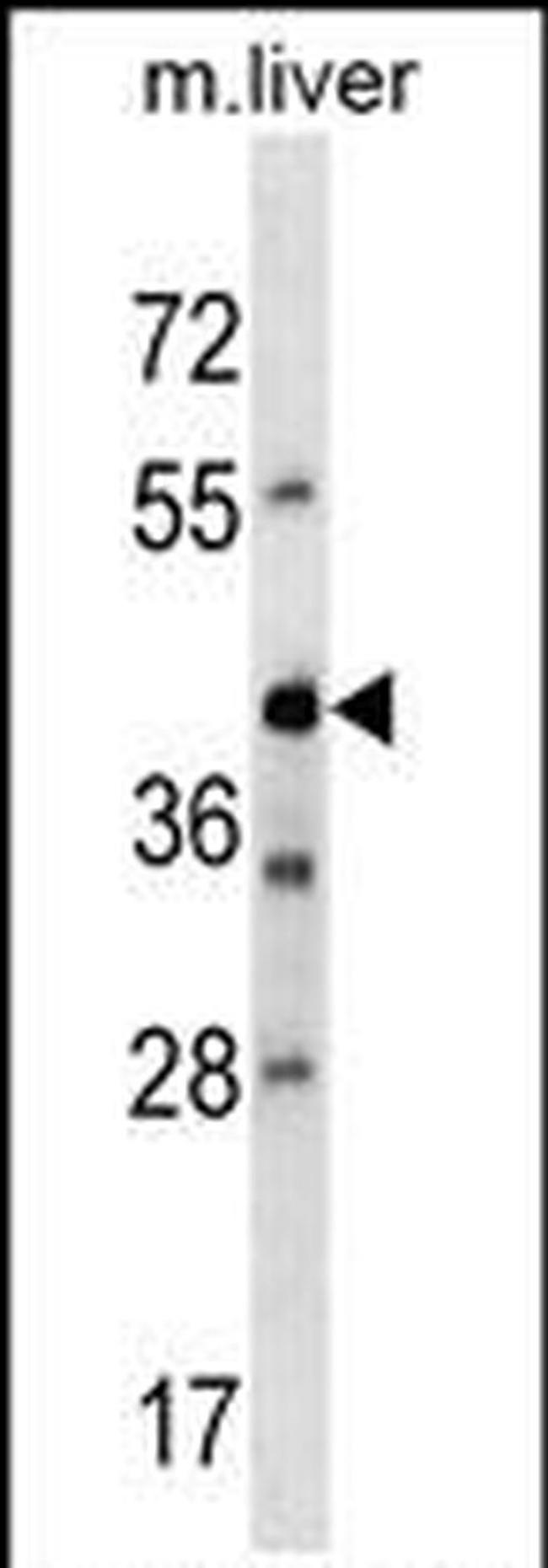 AVPR1B Antibody in Western Blot (WB)