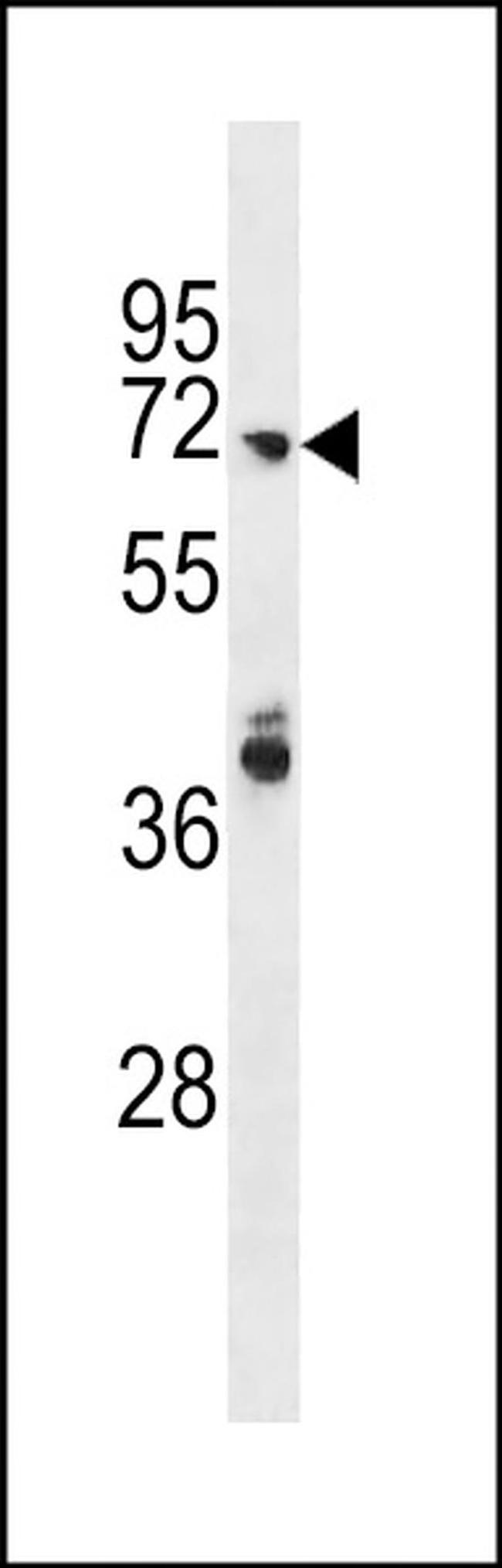 ARHGAP40 Antibody in Western Blot (WB)